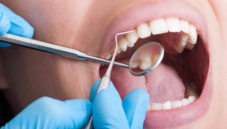 dentista, persona bocca aperta